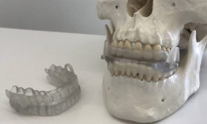 Desarrollan una férula en 3D para evitar la apnea del sueño y los ronquidos